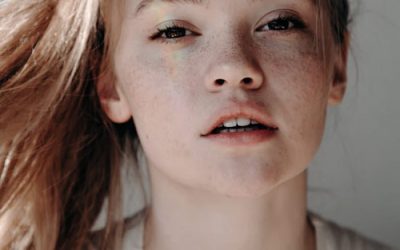 Cómo eliminar las marcas del acné