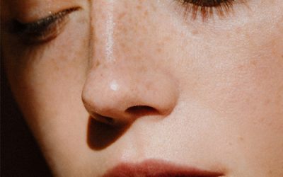 Manchas solares: qué son, por qué aparecen y cómo eliminarlas